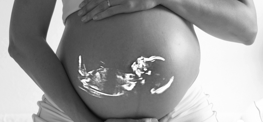 Frequent Ultrasounds for expectant mothers â€“ are they required?