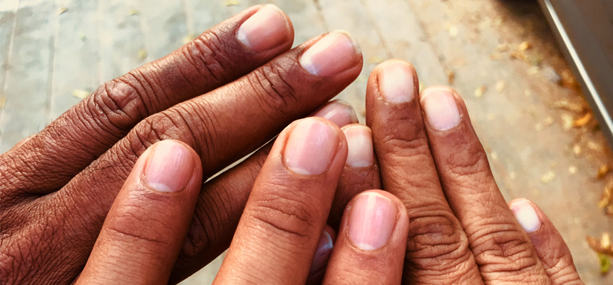 ARE YOUR NAILS TRYING TO TELL YOU SOMETHING?