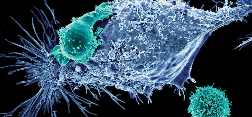 Immunotherapy: a new skyline to Cancer