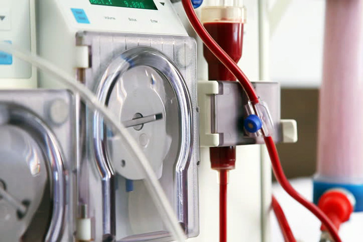 Summer Dos And Donâ€™ts For Kidney Patients