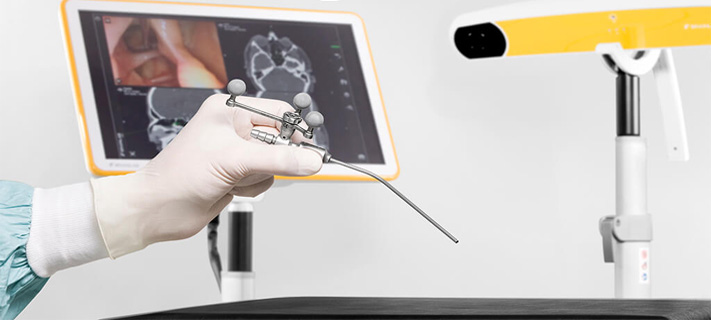 Navigation Robotics For Knee Replacements, Now For The First Time In South India