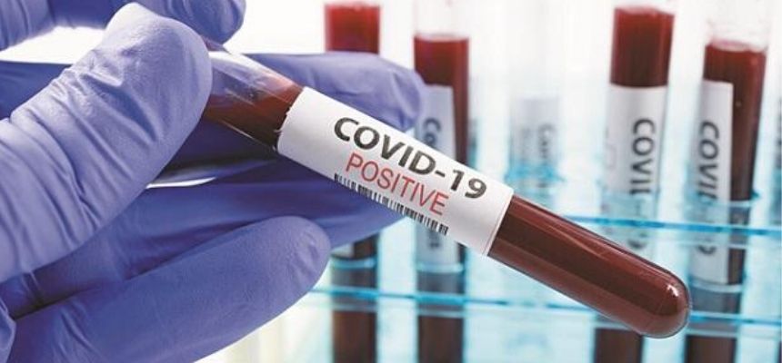 GOVERNMENT OF TELANGANA PERMITS PRIVATE LABS TO CONDUCT COVID 19 TESTING