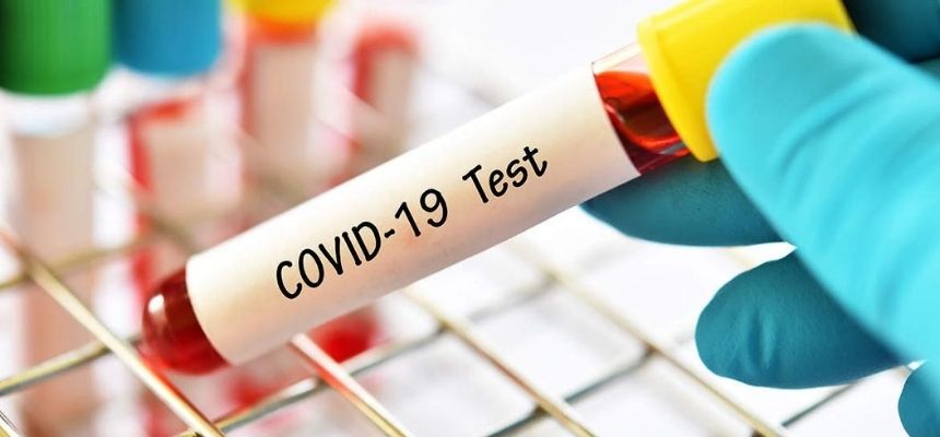 Testing COVID Positive: Advised home care for mild cases
