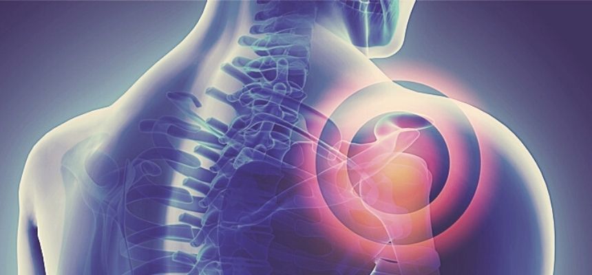 NON SURGICAL PLATELET RICH PLASMA THERAPY FOR CHRONIC SHOULDER PAIN