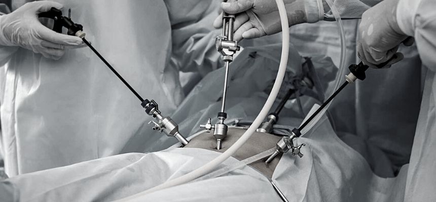 New Technique of Laparoscopic Hysterectomy for Endometrium Carcinoma