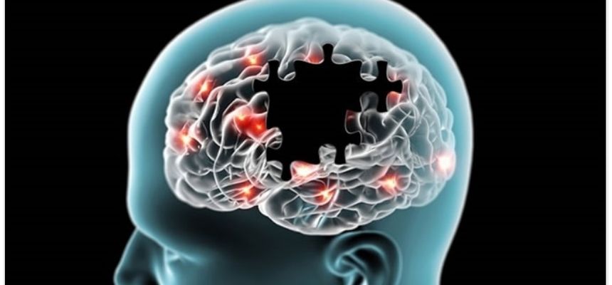 Could Alzheimers begin in the gut