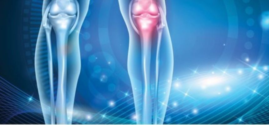 National Bone Joint Day on Aug 4th