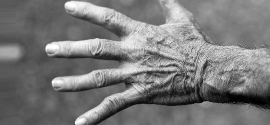 Are we ignoring the impact of arthritis on mental health?