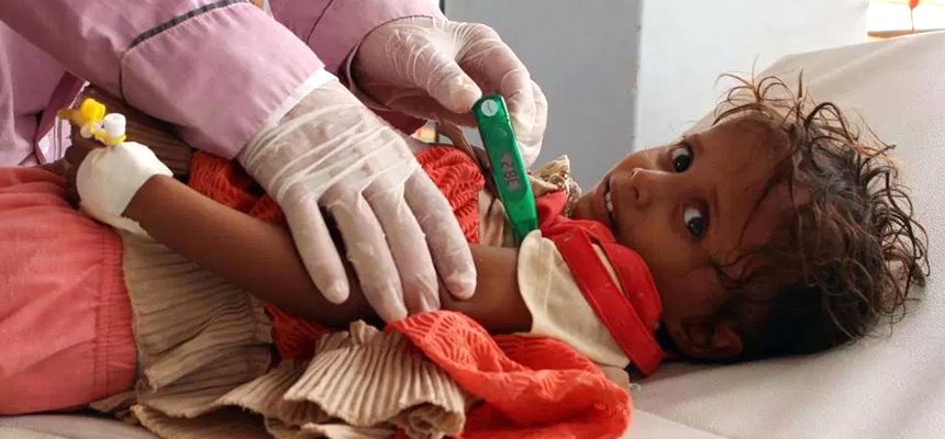Cholera under-recognized health problem in India, study reveals