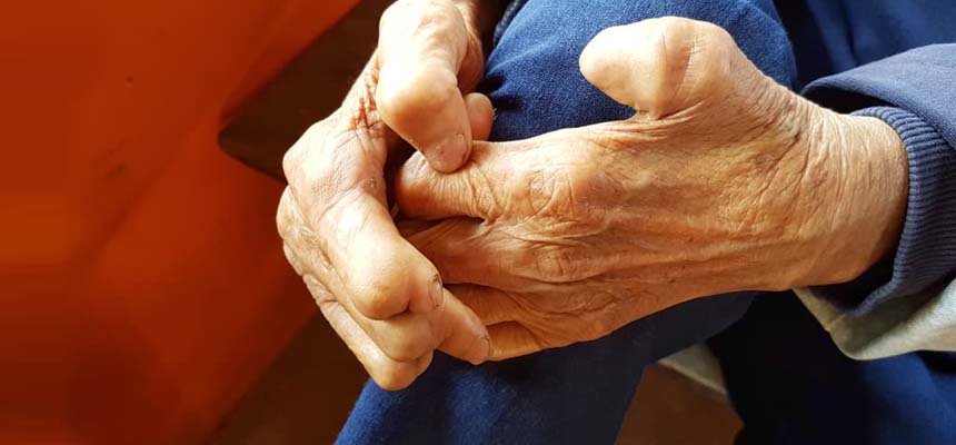 Leprosy- Not a stigma but a curable disease