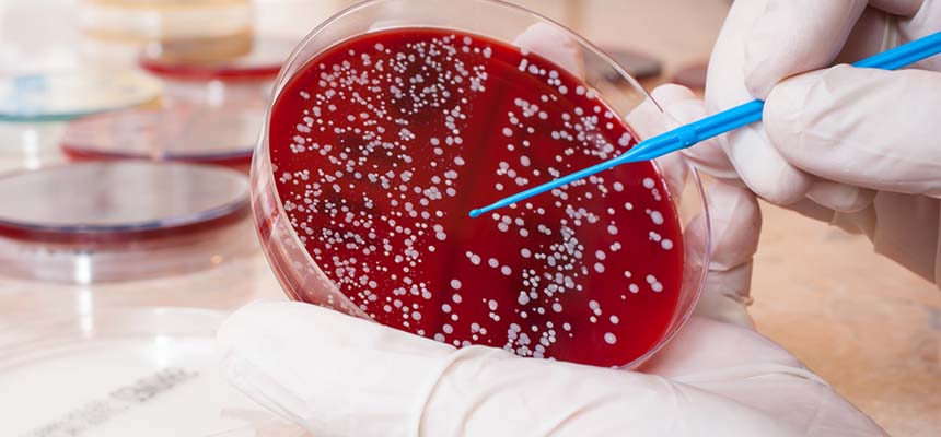 Advances in AML Treatment Improved Cure Rates