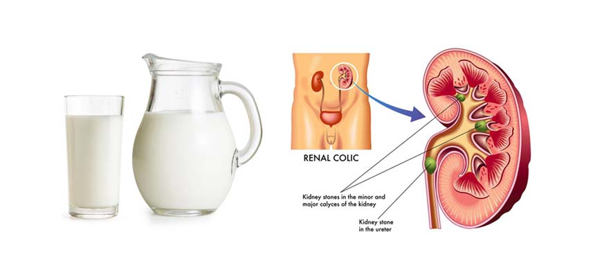 Don't get milked campaign to save kidney's 