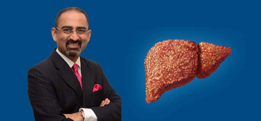 Essential Tips To Manage Liver Disorders