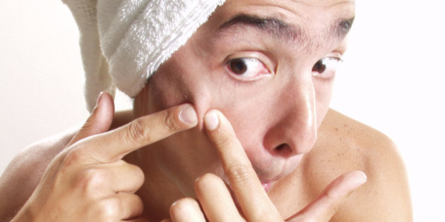 Is popping a pimple bad for Skin?