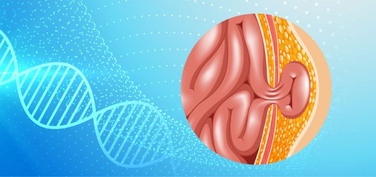 ADVANCEMENTS IN LAPAROSCOPIC HERNIA SURGERY