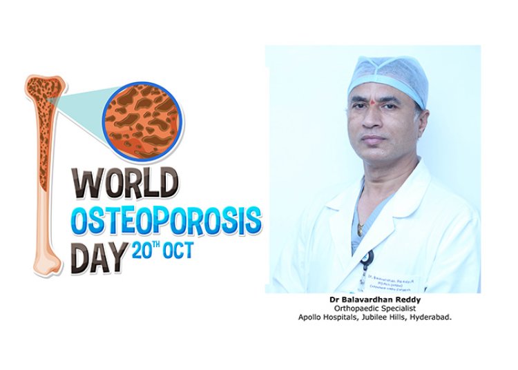 Osteoporosis “a silent thief of your bone”