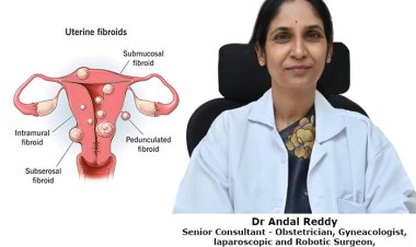 Fibroids in uterus? – what do we need to know.