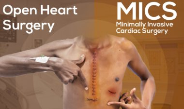 Transforming Heart Care: A Traveler’s Guide to Minimally Invasive Cardiac Surgery