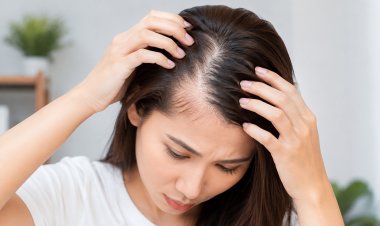 THE CAUSES OF FEMALE PATTERN BALDNESS