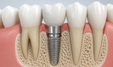 Care for the Teeth