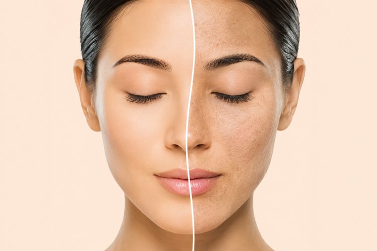 Drive away dry skin !