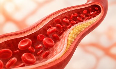 Cholesterol and its Impact on Health